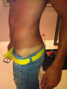 יתרונות השיזוף המבוקר