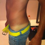 יתרונות השיזוף המבוקר